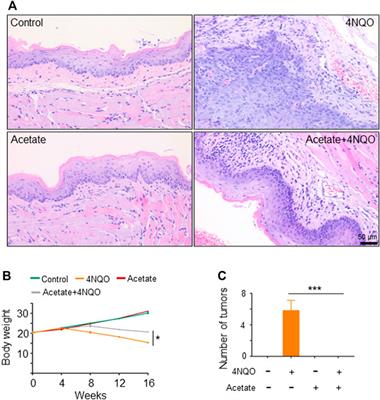 Lactobacillus Suppresses Tumorigenesis of Oropharyngeal Cancer via Enhancing Anti-Tumor Immune Response